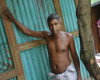 In this April 1, 2016 photo, Shukkur Ali, affected by arsenic poisoning, stands at the entrance to his home in Sonargaon, in the outskirts of Dhaka, Bangladesh. A new report by New York-based Human Rights Watch blames nepotism and neglect by Bangladeshi officials for the high rate of arsenic poisoning affecting nearly 20 million people, a number that has remained unchanged from 10 years ago despite years of action. (AP Photo/ A.M. Ahad)