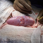 
              In this September 2021 photo provided by NYU Langone Health, a surgical team at the hospital in New York examines a pig kidney attached to the body of a deceased recipient for any signs of rejection. The test was a step in the decades-long quest to one day use animal organs for life-saving transplants. (Joe Carrotta/NYU Langone Health via AP)
            