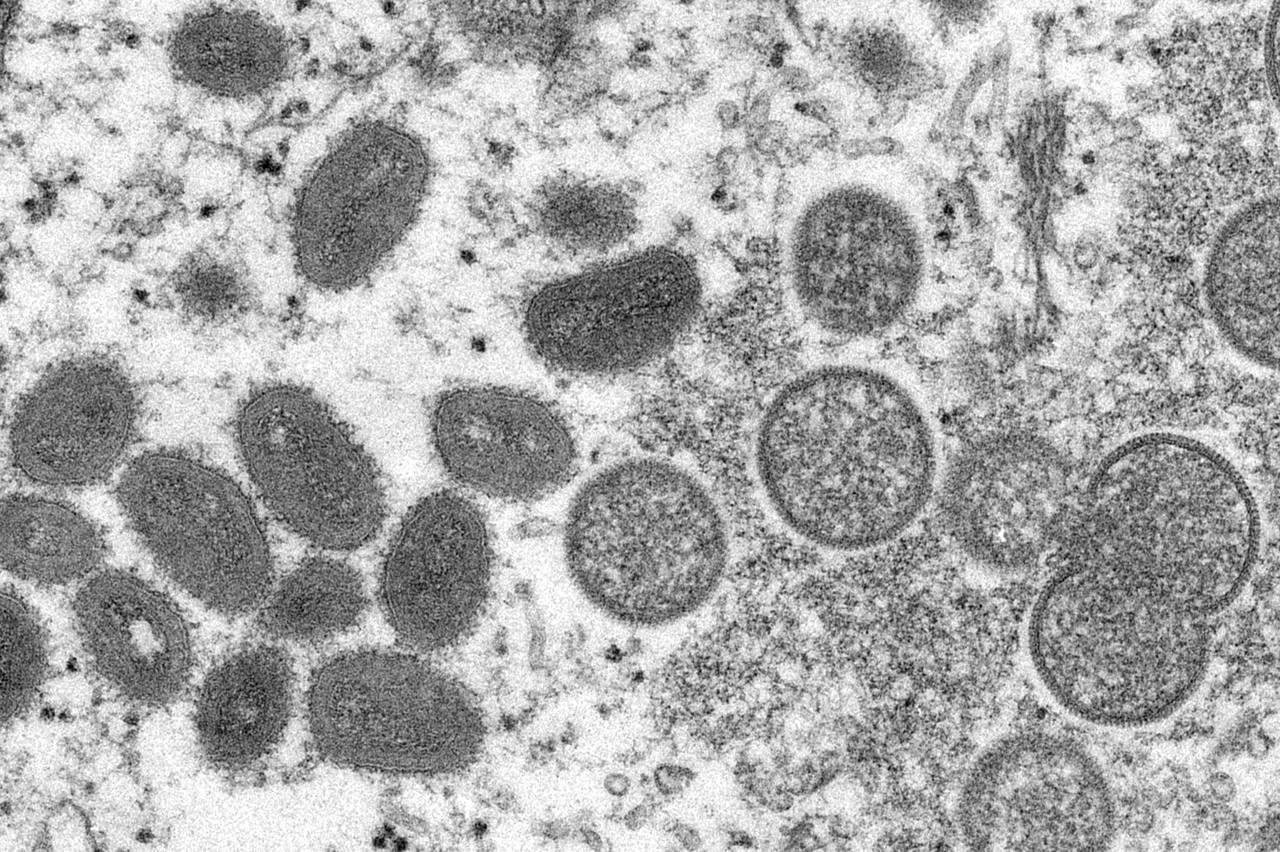 FILE - This 2003 electron microscope image made available by the Centers for Disease Control and Pr...