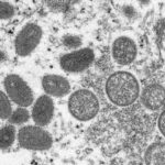
              FILE - This 2003 electron microscope image made available by the Centers for Disease Control and Prevention shows mature, oval-shaped monkeypox virions, left, and spherical immature virions, right, obtained from a sample of human skin associated with the 2003 prairie dog outbreak. (Cynthia S. Goldsmith, Russell Regner/CDC via AP, File)
            