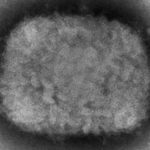 
              FILE - This 2003 electron microscope image made available by the U.S. Centers for Disease Control and Prevention shows a monkeypox virion, obtained from a sample associated with the 2003 prairie dog outbreak. Two children have been diagnosed with monkeypox in the United States: a toddler in California and an infant who is not a U.S. resident, health officials said Friday, July 22, 2022. (Cynthia S. Goldsmith, Russell Regner/CDC via AP, File)
            