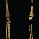 
              The 31,000 year-old-skeleton discovered in a cave in East Kalimantan, Borneo Indonesia, is photographed at Griffith University in Brisbane, Australia, Sept. 1, 2022. The remains, which have been dated to 31,000 years old, mark the oldest evidence for amputation yet discovered. And the prehistoric “surgery” could show that humans were making medical advances much earlier than previously thought, according to the study published Wednesday, Sept. 7, 2022 in the journal Nature. (Tim Maloney/Griffith University via AP)
            