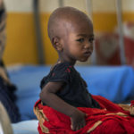 
              A malnourished child sits at a clinic in Dollow, Somalia, on Wednesday, Sept. 21, 2022. Within weeks, a famine could be declared in Somalia, affecting hundreds of thousands of people. Such a declaration is rare and a sign of the dire consequences from the worst drought in decades in the Horn of Africa. (AP Photo/Jerome Delay)
            