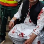 
              In this photo released by former Pakistani Prime Minister Imran Khan's party, Pakistan Tehreek-e-Insaf, Faisal Javed, a senator and close aid of Khan, who was  injured in a shooting incident waits to receive first aid, in in Wazirabad, Pakistan, Thursday, Nov. 3, 2022. A gunman opened fire at a campaign truck carrying Khan on Thursday, wounding him slightly and also some of his supporters, a senior leader from his party and police said. (Pakistan Tehreek-e-Insaf via AP)
            