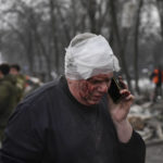 
              A wounded man speaks on the phone as Donetsk's emergency employees work at a site of a shopping center destroyed after what Russian officials in Donetsk said it was a shelling by Ukrainian forces, in Donetsk, in Russian-controlled Donetsk region, eastern Ukraine, Monday, Jan. 16, 2023. (AP Photo)
            