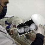
              Doctor Hani Maarouf looks at an x-ray of a baby girl who was born under the rubble caused by an earthquake that hit Syria and Turkey, as she lays inside an incubator at a children's hospital in the town of Afrin, Aleppo province, Syria, Thursday, Feb. 9, 2023. The baby girl is the only survivor in her family after her parents and four siblings were killed in Monday's 7.8 magnitude quake that hit southern Turkey and northern Syria. She has been given a name, Aya, Maarouf who is treating her said Thursday. (AP Photo/Ghaith Alsayed)
            