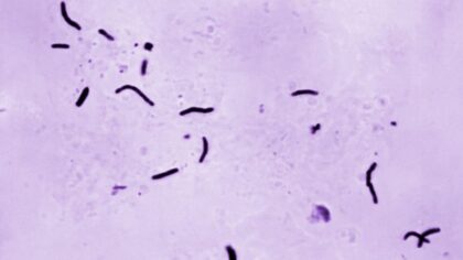 16 in Yakima County sick with tuberculosis