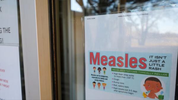 Public Health warns of measles exposure in Seattle, Kirkland, and ...