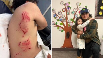 Man mauled by ICE K9 in Vancouver released from ICE custody