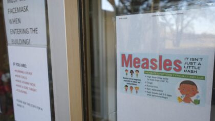 'We are entering a new, more dangerous stage': WA reports 40 measles cases in 2026, more than triple all of 2025