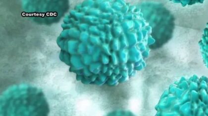 Parasite causing 'explosive' diarrhea surges nationwide, but King County cases remain at normal levels