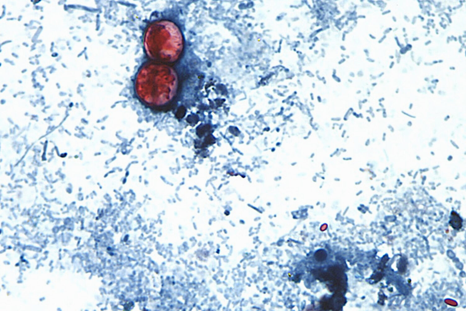 FILE - This undated photo taken through a microscope provided by the CDC shows Cyclospora cayetanen...