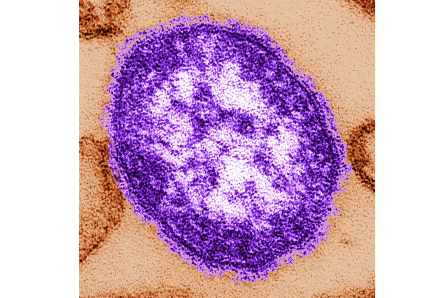 FILE - This undated image made available by the Centers for Disease Control and Prevention on Feb. ...