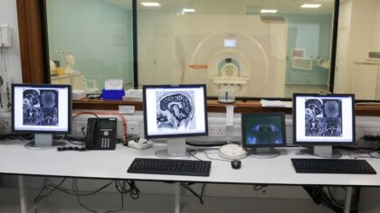 MRI tumor...