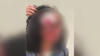 downtown seattle woman bit...