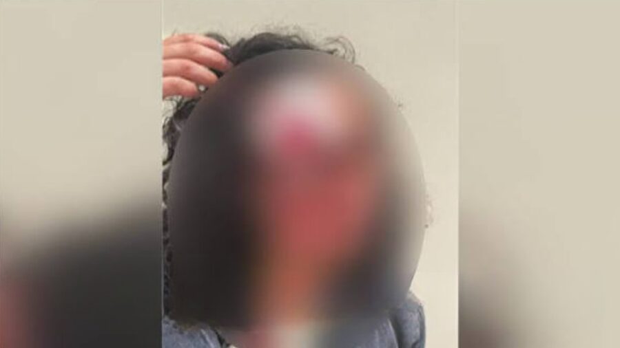 downtown seattle woman bit...