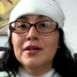 ‘I didn’t think she bit a chunk off’: Seattle woman whose forehead was bitten by random attacker speaks out